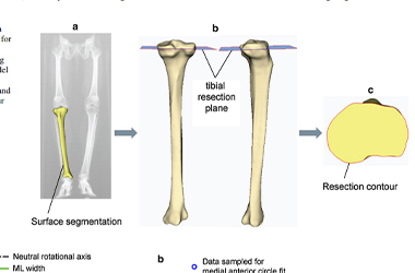 anatomic tibial publication by Dr tarabichi