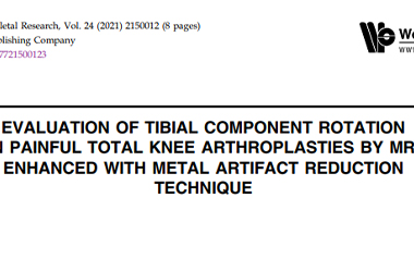 evaluation of tibial component Publication by Dr Tarabichi