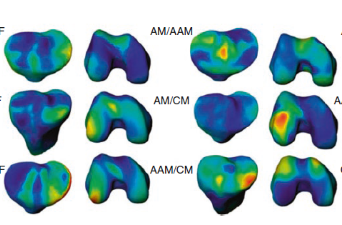 Morphometric Analysis